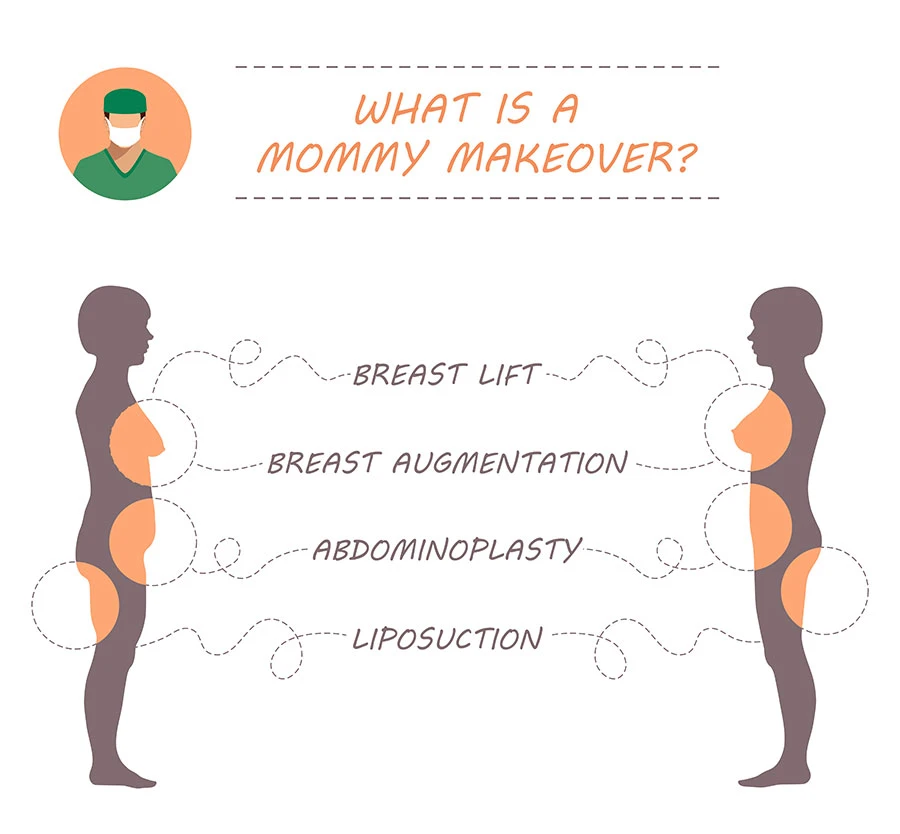 Mommy Makeover Procedure Illustration