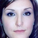 Rhinoplasty Before & After Patient #1548
