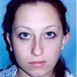 Otoplasty Before & After Patient #1959